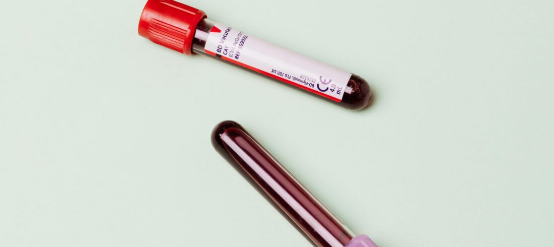 sumber pexels hemoglobin